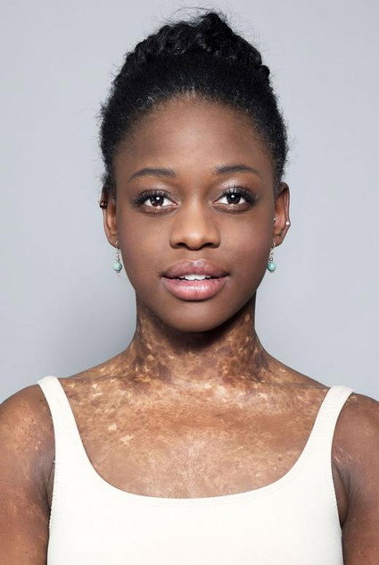 Zdjęcie Michaela DePrince